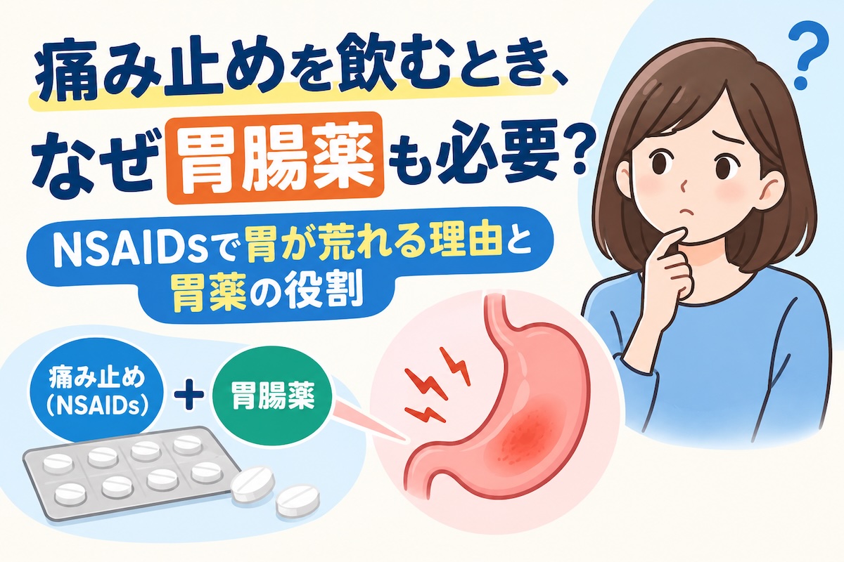 痛み止めを飲むとき、なぜ胃腸薬も必要?NSAIDsで胃が荒れる理由と胃薬の役割